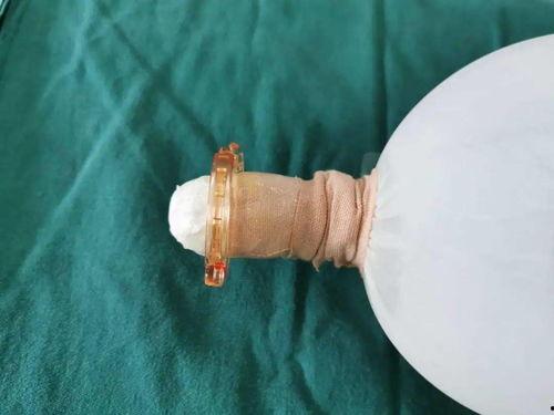 包皮手术过程视频,专业视角下的手术步骤解析